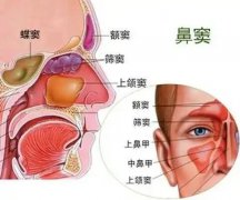 【全國(guó)愛(ài)鼻日】孩子出現(xiàn)這些癥狀，警惕鼻竇炎！ 